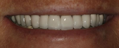 Knosville Cosmetic Dentist After
