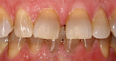 Cosmetic Dentist Before Photo