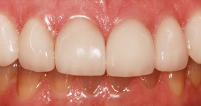 Cosmetic Dentist After Photo